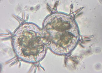 Microalgas em Parintins: Estudo Revela 200 Espécies